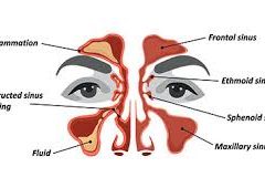 sinus