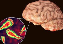 Brain Eating Amoeba 1