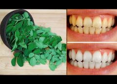 TEETH